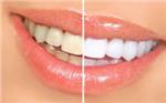 How to make teeth white naturally from yellow?